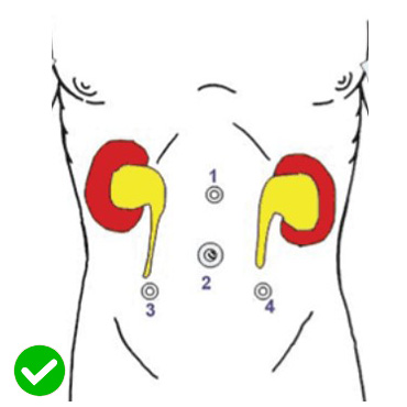 Paediatric Robotic Urology and Surgery