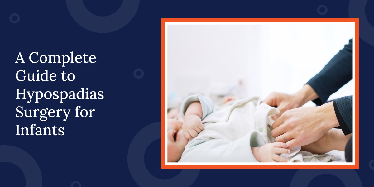 A Complete Guide to Hypospadias Surgery for Infants