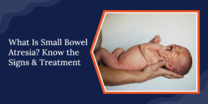 What Is Small Bowel Atresia? Know the Signs & Treatment