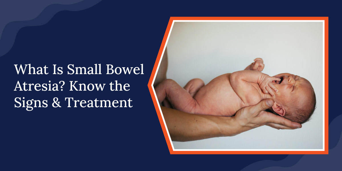 What Is Small Bowel Atresia? Know the Signs & Treatment